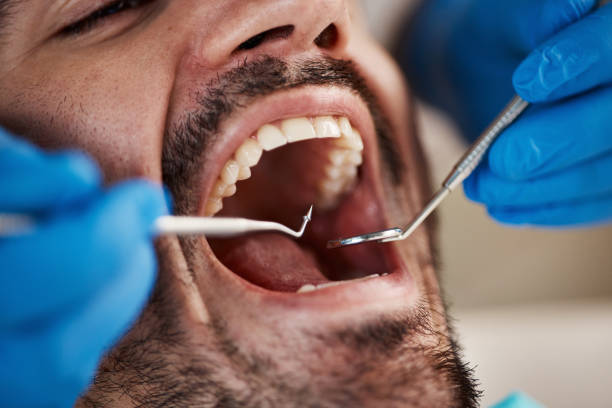Best Broken or Cracked Tooth Emergency Dentist in Oak Hills, OR